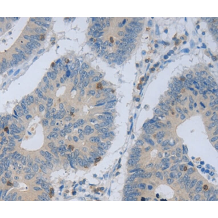 Immunohistochemistry - MAGEB4 Antibody from Signalway Antibody (35808) - Antibodies.com
