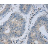 Immunohistochemistry - MAGEB4 Antibody from Signalway Antibody (35808) - Antibodies.com