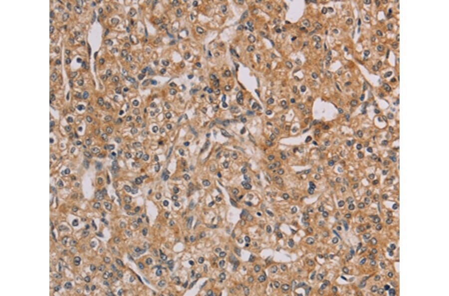 Immunohistochemistry - CHRNA4 Antibody from Signalway Antibody (35829) - Antibodies.com