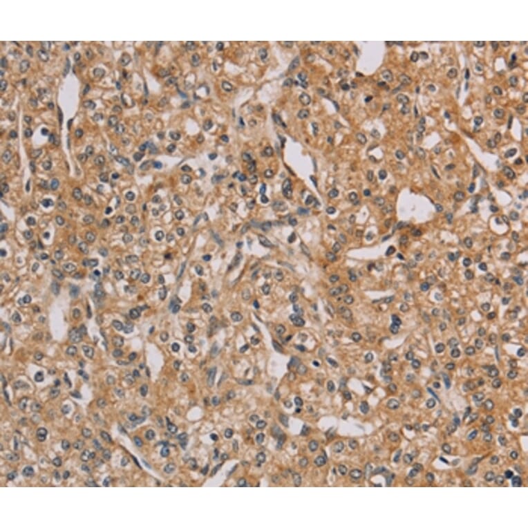 Immunohistochemistry - CHRNA4 Antibody from Signalway Antibody (35829) - Antibodies.com