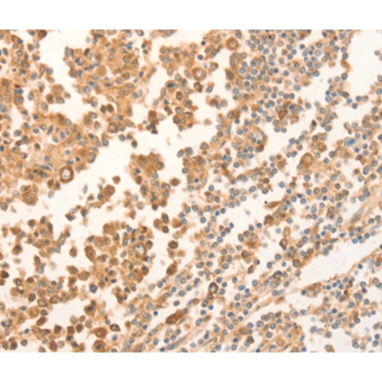 Immunohistochemistry - NAP1L1 Antibody from Signalway Antibody (35831) - Antibodies.com