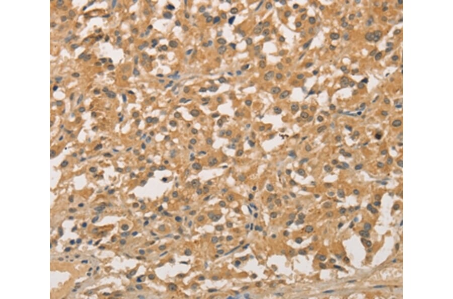 Immunohistochemistry - NFE2L1 Antibody from Signalway Antibody (35844) - Antibodies.com