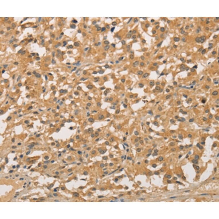 Immunohistochemistry - NFE2L1 Antibody from Signalway Antibody (35844) - Antibodies.com