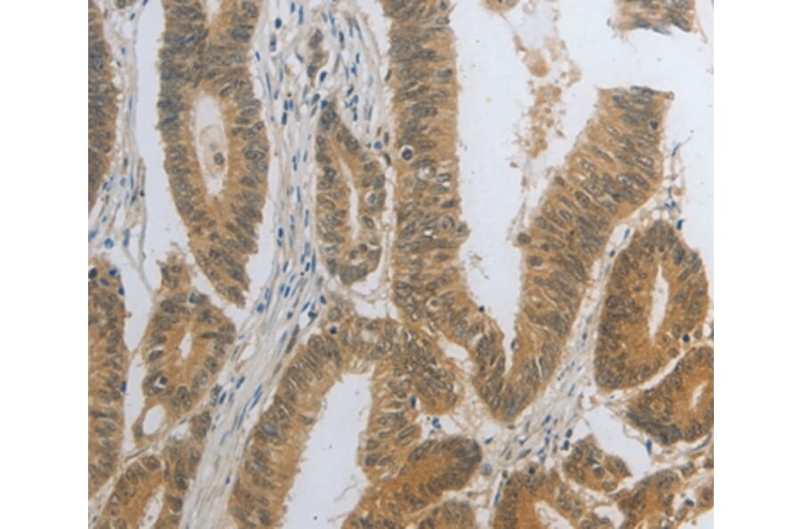 Immunohistochemistry - DNAJC7 Antibody from Signalway Antibody (35858) - Antibodies.com