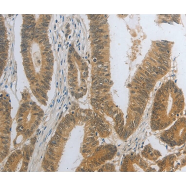Immunohistochemistry - DNAJC7 Antibody from Signalway Antibody (35858) - Antibodies.com