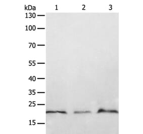PTP4A2 Antibody from Signalway Antibody (35892) - Antibodies.com