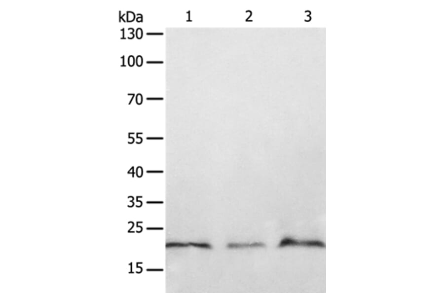 PTP4A2 Antibody from Signalway Antibody (35892) - Antibodies.com