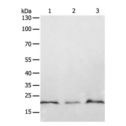 PTP4A2 Antibody from Signalway Antibody (35892) - Antibodies.com