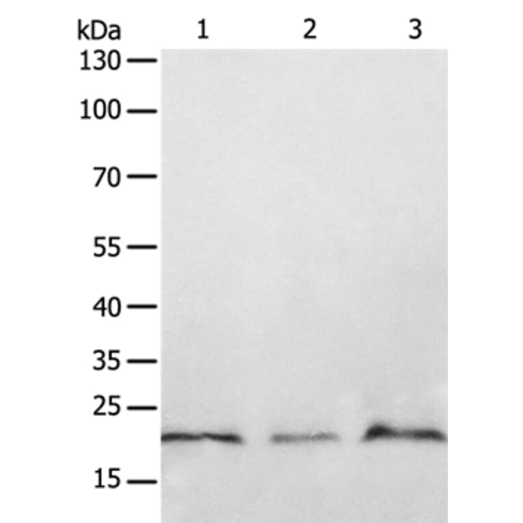 PTP4A2 Antibody from Signalway Antibody (35892) - Antibodies.com