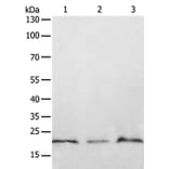 PTP4A2 Antibody from Signalway Antibody (35892) - Antibodies.com