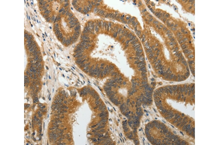Immunohistochemistry - PTP4A2 Antibody from Signalway Antibody (35892) - Antibodies.com
