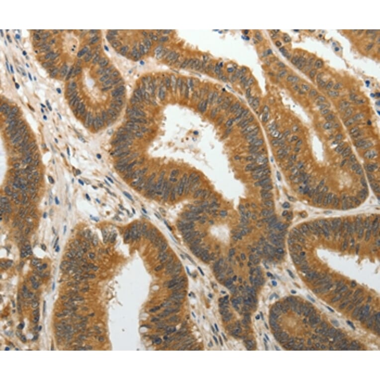 Immunohistochemistry - PTP4A2 Antibody from Signalway Antibody (35892) - Antibodies.com