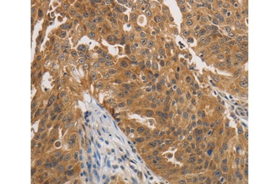 Immunohistochemistry - PTPN11 Antibody from Signalway Antibody (35913) - Antibodies.com