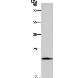 TAGLN2 Antibody from Signalway Antibody (35920) - Antibodies.com