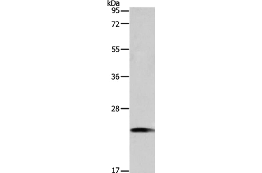 TAGLN2 Antibody from Signalway Antibody (35920) - Antibodies.com