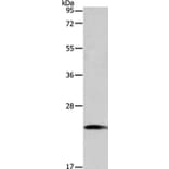 TAGLN2 Antibody from Signalway Antibody (35920) - Antibodies.com