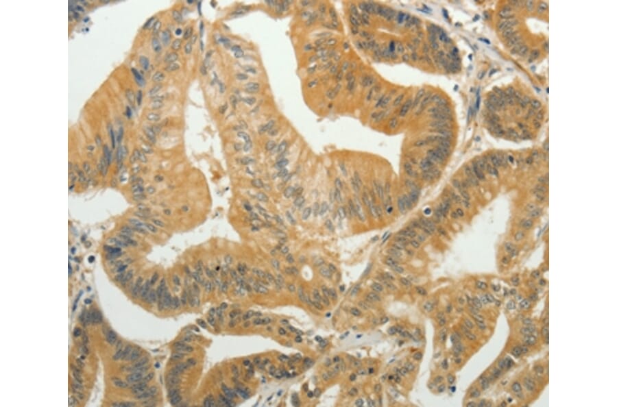 Immunohistochemistry - TAGLN2 Antibody from Signalway Antibody (35920) - Antibodies.com