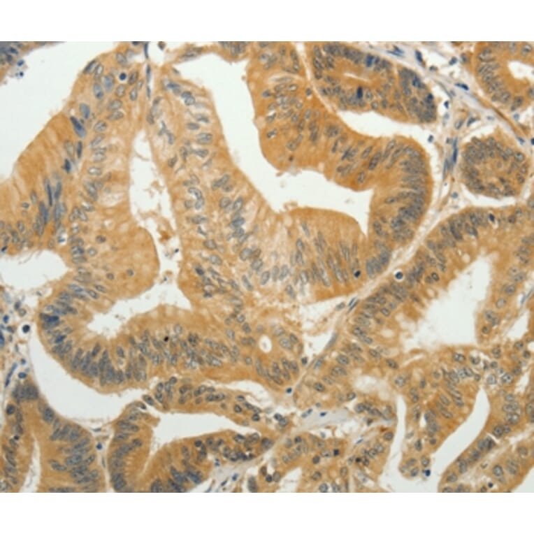 Immunohistochemistry - TAGLN2 Antibody from Signalway Antibody (35920) - Antibodies.com