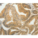Immunohistochemistry - TAGLN2 Antibody from Signalway Antibody (35920) - Antibodies.com