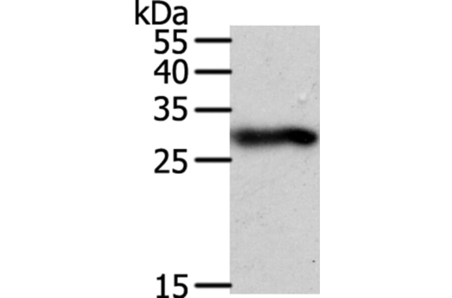 SPIN2B Antibody from Signalway Antibody (35931) - Antibodies.com