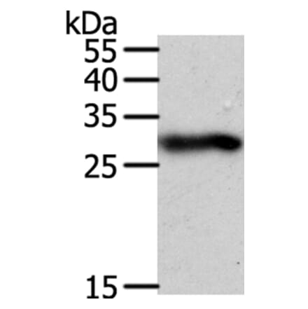 SPIN2B Antibody from Signalway Antibody (35931) - Antibodies.com