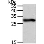 SPIN2B Antibody from Signalway Antibody (35931) - Antibodies.com