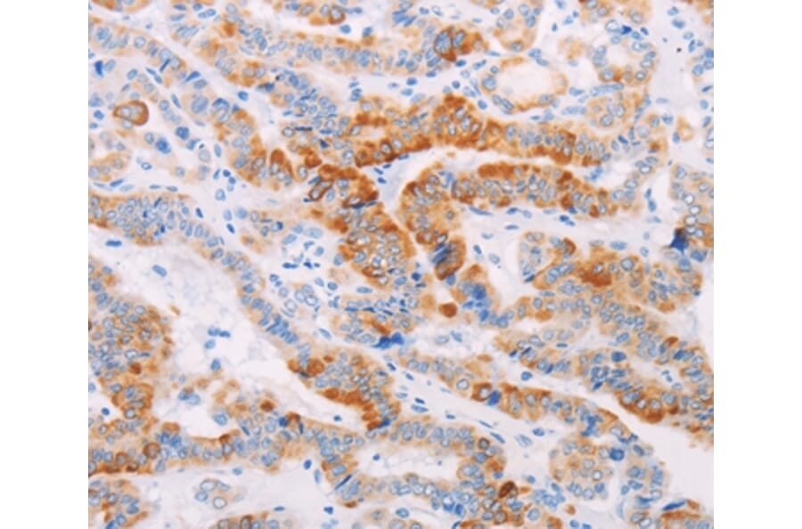 Immunohistochemistry - MAP4K3 Antibody from Signalway Antibody (35951) - Antibodies.com