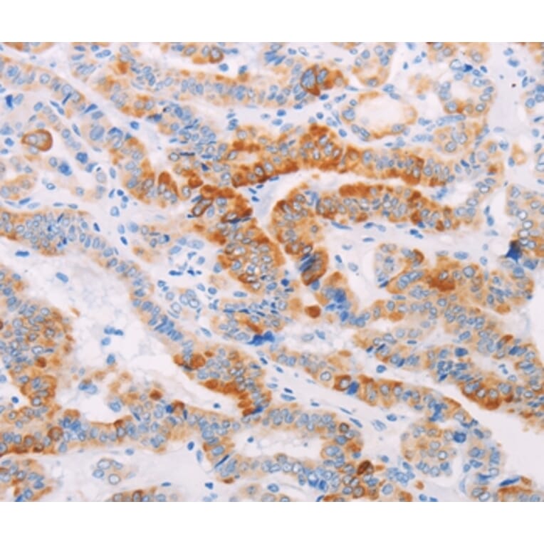 Immunohistochemistry - MAP4K3 Antibody from Signalway Antibody (35951) - Antibodies.com