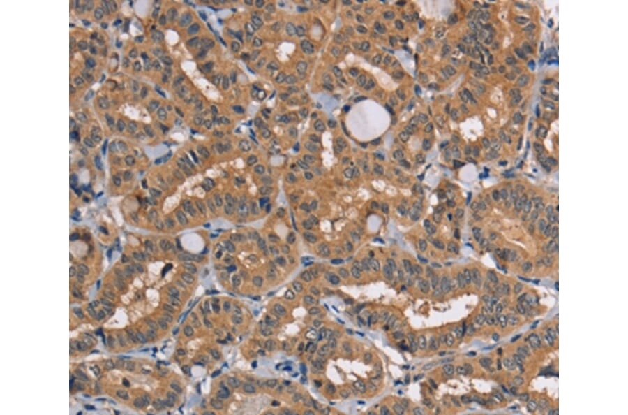 Immunohistochemistry - TRAFD1 Antibody from Signalway Antibody (35973) - Antibodies.com
