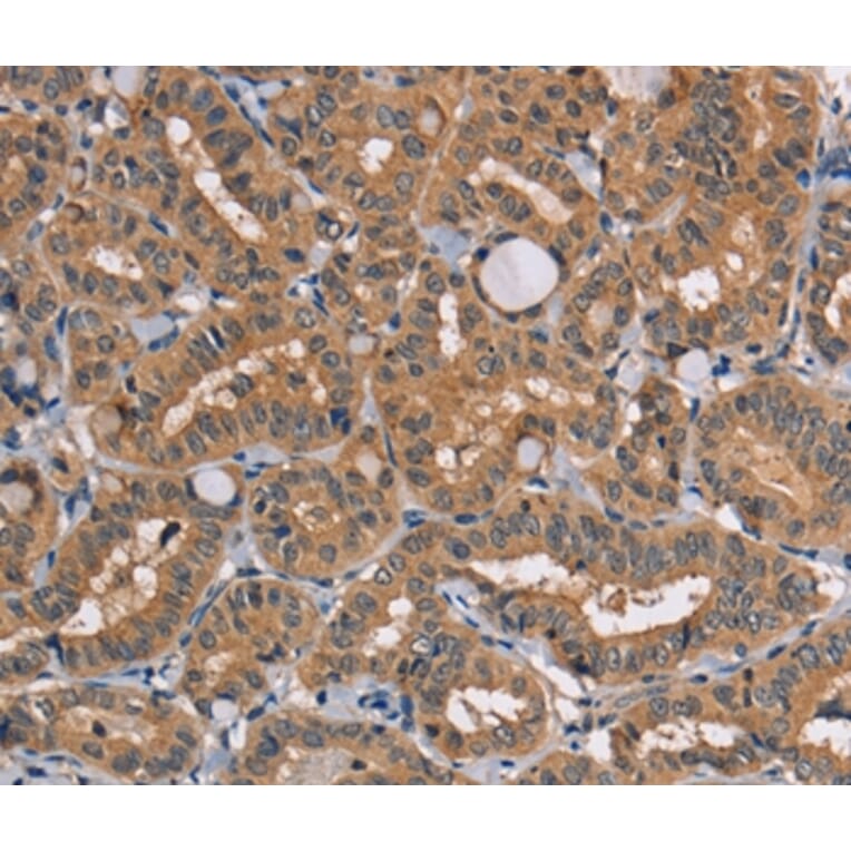 Immunohistochemistry - TRAFD1 Antibody from Signalway Antibody (35973) - Antibodies.com