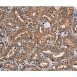 Immunohistochemistry - TRAFD1 Antibody from Signalway Antibody (35973) - Antibodies.com