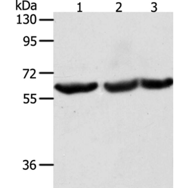 TRIM32 Antibody from Signalway Antibody (35975) - Antibodies.com