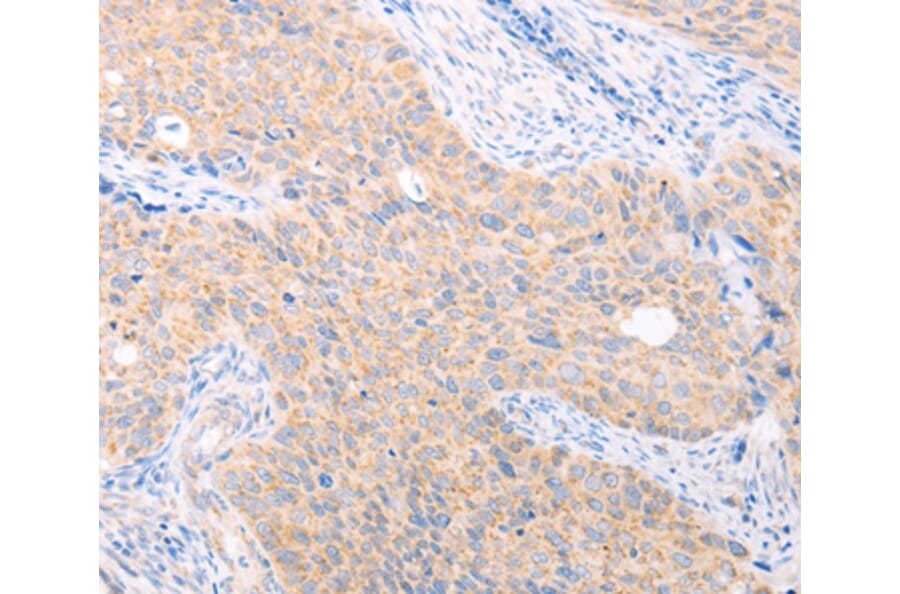 Immunohistochemistry - TRIM32 Antibody from Signalway Antibody (35975) - Antibodies.com