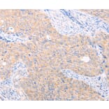 Immunohistochemistry - TRIM32 Antibody from Signalway Antibody (35975) - Antibodies.com