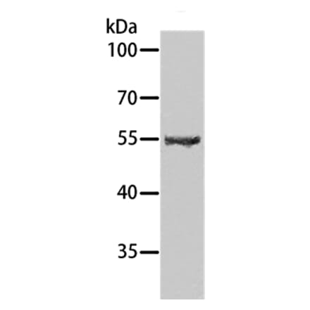 SPATA6 Antibody from Signalway Antibody (35978) - Antibodies.com