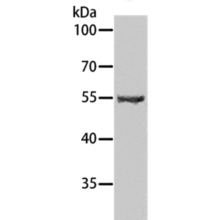 SPATA6 Antibody from Signalway Antibody (35978) - Antibodies.com