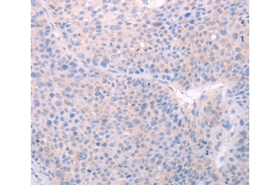 Immunohistochemistry - SPATA6 Antibody from Signalway Antibody (35978) - Antibodies.com