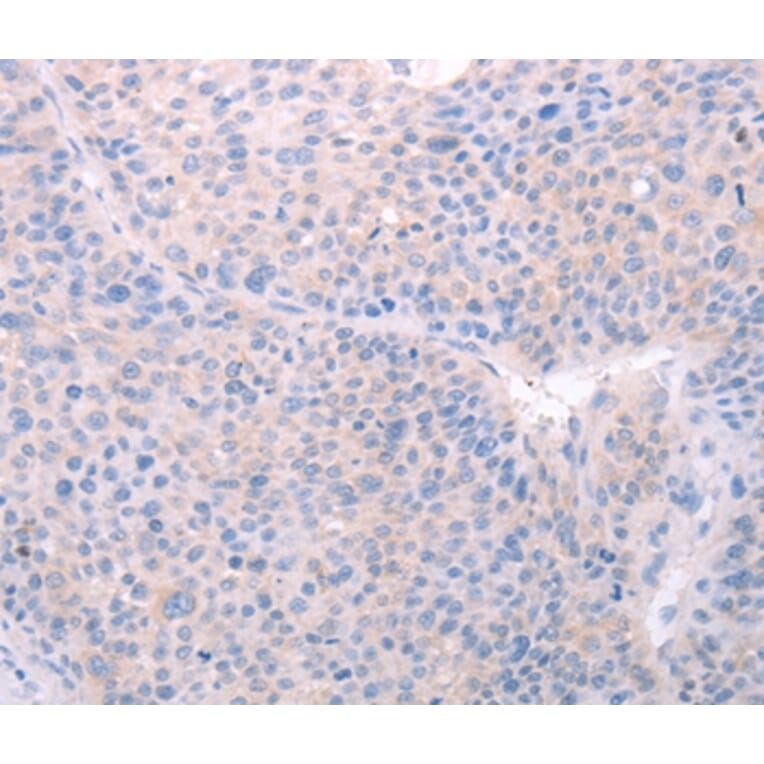 Immunohistochemistry - SPATA6 Antibody from Signalway Antibody (35978) - Antibodies.com