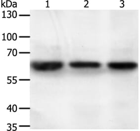 STXBP2 Antibody from Signalway Antibody (35985) - Antibodies.com