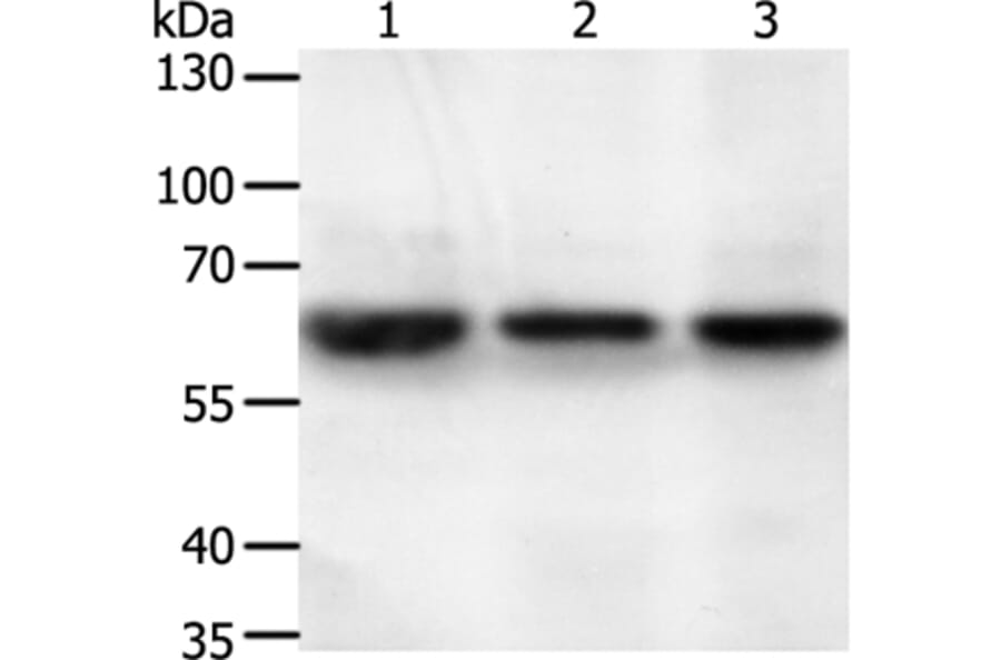 STXBP2 Antibody from Signalway Antibody (35985) - Antibodies.com