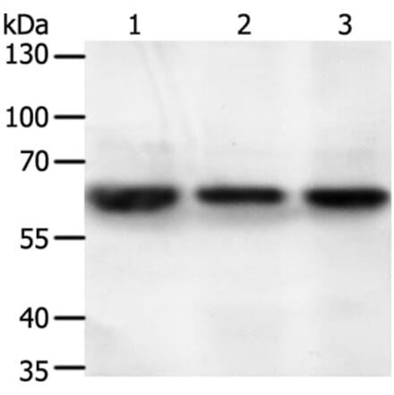 STXBP2 Antibody from Signalway Antibody (35985) - Antibodies.com