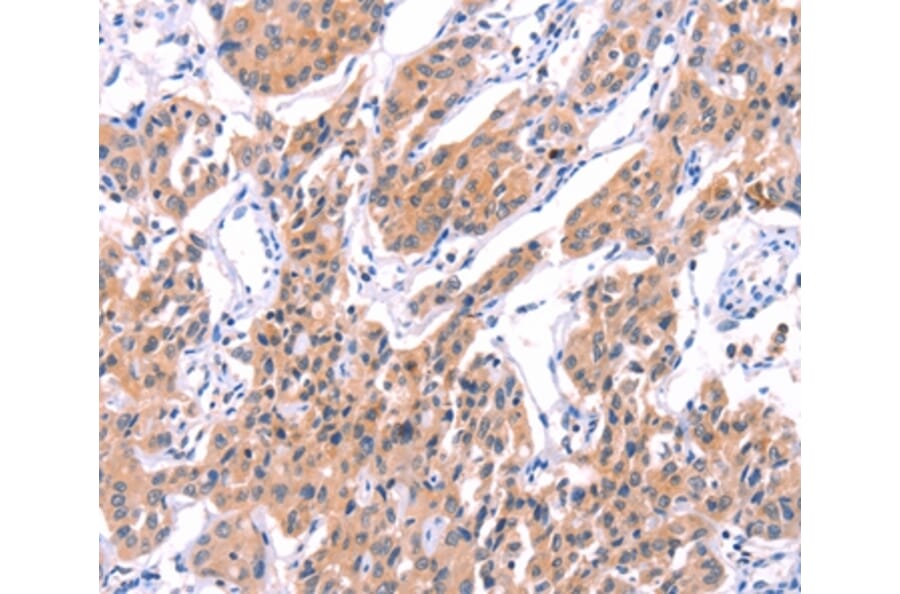 Immunohistochemistry - STXBP2 Antibody from Signalway Antibody (35985) - Antibodies.com
