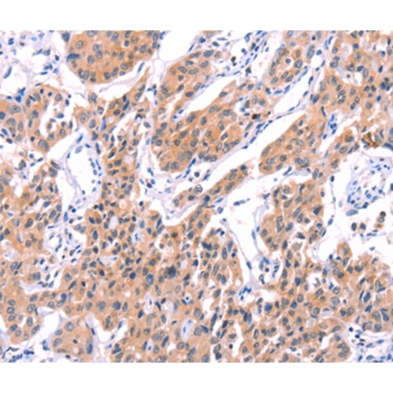 Immunohistochemistry - STXBP2 Antibody from Signalway Antibody (35985) - Antibodies.com
