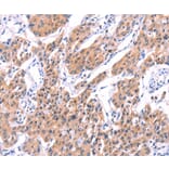 Immunohistochemistry - STXBP2 Antibody from Signalway Antibody (35985) - Antibodies.com