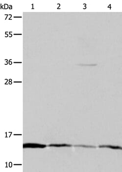 Gel: 16%+12%+10% SDS-PAGE Lysates (from left to right): Hela, Jurkat, MCF7 and A431 cell Amount of lysate: 40ug per lane Primary antibody: 1/1200 dilution Secondary antibody dilution: 1/8000 Exposure time: 2 minutes