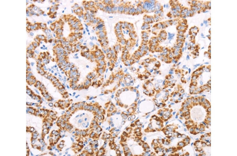 Immunohistochemistry - ATPIF1 Antibody from Signalway Antibody (35986) - Antibodies.com