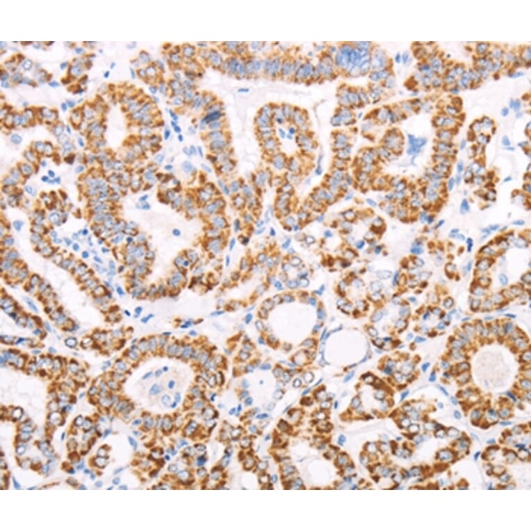 Immunohistochemistry - ATPIF1 Antibody from Signalway Antibody (35986) - Antibodies.com