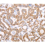 Immunohistochemistry - ATPIF1 Antibody from Signalway Antibody (35986) - Antibodies.com