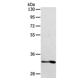IL1RL1 Antibody from Signalway Antibody (35992) - Antibodies.com
