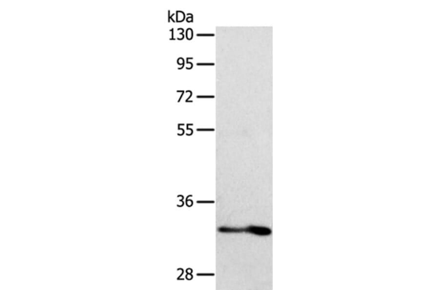 IL1RL1 Antibody from Signalway Antibody (35992) - Antibodies.com